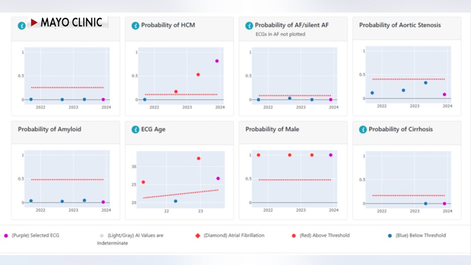 multiple graphs show a patients probability of certain heart conditions using an ai enhanced ecg